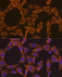 Invitrogen CAD Recombinant Rabbit Monoclonal Antibody (0O8D6) 100 &mu;L;