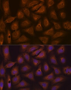 Invitrogen CAD Recombinant Rabbit Monoclonal Antibody (0O8D6) 100 &mu;L;
