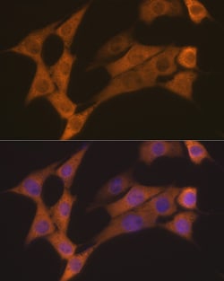 Invitrogen Cyclin B2 Recombinant Rabbit Monoclonal Antibody (1L9B9) 100