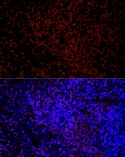 Invitrogen IKZF3 Recombinant Rabbit Monoclonal Antibody (4U7F9) 100 &mu;L;
