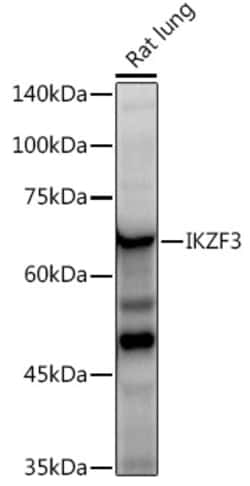 Invitrogen IKZF3 Recombinant Rabbit Monoclonal Antibody (4U7F9) 100 &mu;L;