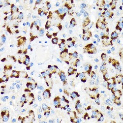 Invitrogen A-Raf Recombinant Rabbit Monoclonal Antibody (4U9L7) 100 &mu;L;