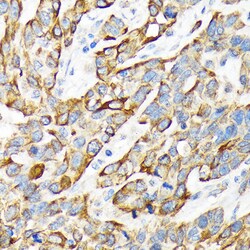 Invitrogen Cytokeratin 16 Recombinant Rabbit Monoclonal Antibody (8L6R4) 100 &mu;L | Buy Online | Invitrogen&trade; | Fisher Scientific