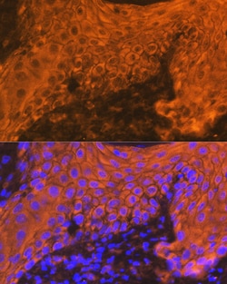 Invitrogen Cytokeratin 16 Recombinant Rabbit Monoclonal Antibody (8L6R4) 100 &mu;L | Buy Online | Invitrogen&trade; | Fisher Scientific