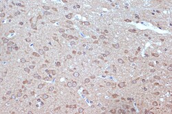 Invitrogen BAG2 Recombinant Rabbit Monoclonal Antibody (6D6Z0) 100 &mu;L;