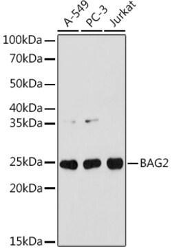 Invitrogen BAG2 Recombinant Rabbit Monoclonal Antibody (6D6Z0) 100 &mu;L;