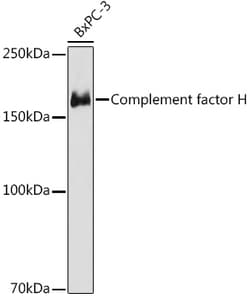 Invitrogen Complement Factor H Recombinant Rabbit Monoclonal Antibody (10M8Q5) 100 &mu;L | Buy Online | Invitrogen&trade; | Fisher Scientific