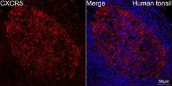Invitrogen CXCR5 Recombinant Rabbit Monoclonal Antibody (9Q10I2) 100 &mu;L;