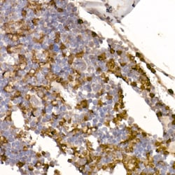 Invitrogen Neutrophil elastase Recombinant Rabbit Monoclonal Antibody (8X4E6)