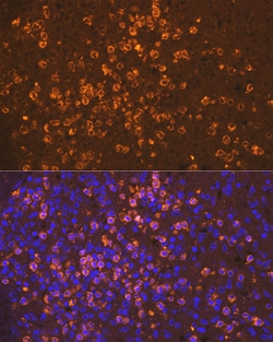 Invitrogen Neutrophil elastase Recombinant Rabbit Monoclonal Antibody (8X4E6)