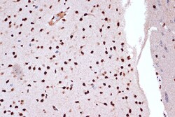 Invitrogen FUBP1 Recombinant Rabbit Monoclonal Antibody (1G6X5) 100 &mu;L;