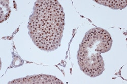 Invitrogen KIF4A Recombinant Rabbit Monoclonal Antibody (4A9P2) 100 &mu;L;