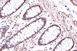 Invitrogen KIF4A Recombinant Rabbit Monoclonal Antibody (4A9P2) 100 &mu;L;