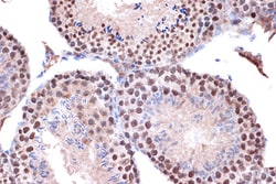 Invitrogen KIF4A Recombinant Rabbit Monoclonal Antibody (4A9P2) 100 &mu;L;