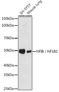 Invitrogen NFIB Recombinant Rabbit Monoclonal Antibody (7T1G5) 100 &mu;L | Buy Online | Invitrogen&trade; | Fisher Scientific