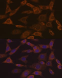 Invitrogen Ephrin A1 Recombinant Rabbit Monoclonal Antibody (5D4Q5) 100