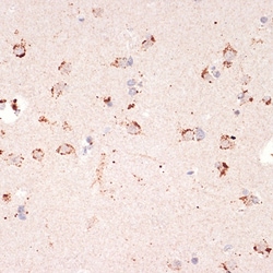 Invitrogen Ephrin A1 Recombinant Rabbit Monoclonal Antibody (5D4Q5) 100