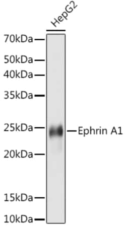 Invitrogen Ephrin A1 Recombinant Rabbit Monoclonal Antibody (5D4Q5) 100