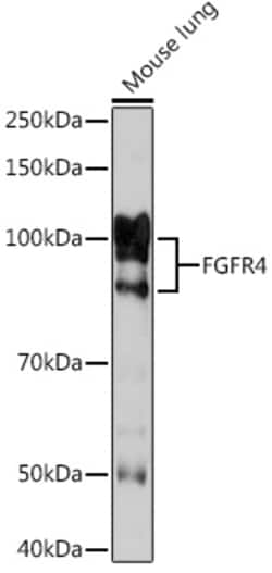 Invitrogen FGFR4 Recombinant Rabbit Monoclonal Antibody (2C4E1) 100 &mu;L | Buy Online | Invitrogen&trade; | Fisher Scientific
