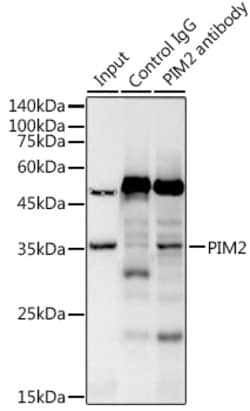 Invitrogen PIM2 Recombinant Rabbit Monoclonal Antibody (3V1S5) 100 &mu;L | Buy Online | Invitrogen&trade; | Fisher Scientific