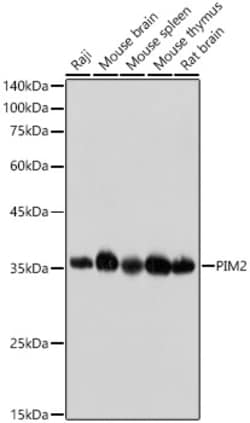 Invitrogen PIM2 Recombinant Rabbit Monoclonal Antibody (3V1S5) 100 &mu;L | Buy Online | Invitrogen&trade; | Fisher Scientific
