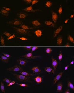 Invitrogen CaMKIV Recombinant Rabbit Monoclonal Antibody (1G4P4) 100 &mu;L;