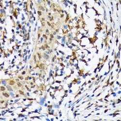 Invitrogen CaMKIV Recombinant Rabbit Monoclonal Antibody (1G4P4) 100 &mu;L;
