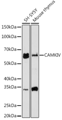 Invitrogen CaMKIV Recombinant Rabbit Monoclonal Antibody (1G4P4) 100 &mu;L;