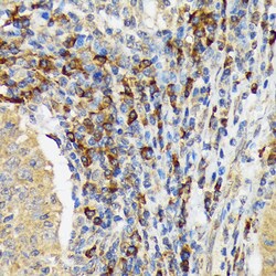 Invitrogen VAV3 Recombinant Rabbit Monoclonal Antibody (9A10D8) 100 &mu;L | Buy Online | Invitrogen&trade; | Fisher Scientific