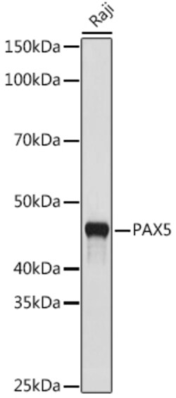 Invitrogen PAX5 Recombinant Rabbit Monoclonal Antibody (4I0X4) 100 &mu;L;