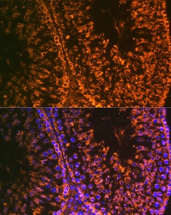 Invitrogen LIN28A Recombinant Rabbit Monoclonal Antibody (2S1I10) 100 &mu;L;