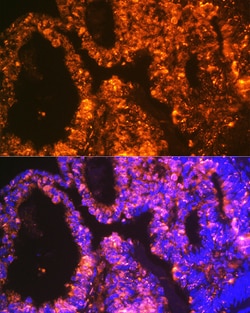 Invitrogen LIN28A Recombinant Rabbit Monoclonal Antibody (2S1I10) 100 &mu;L;