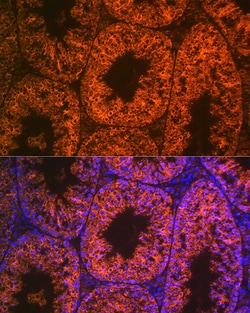 Invitrogen LIN28A Recombinant Rabbit Monoclonal Antibody (2S1I10) 100 &mu;L;
