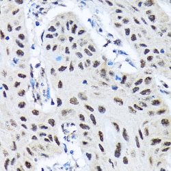 Invitrogen SMN1 Recombinant Rabbit Monoclonal Antibody (9N9Q6) 100 &mu;L;