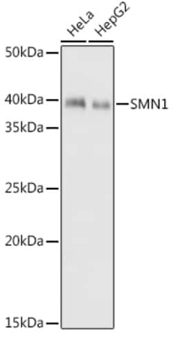 Invitrogen SMN1 Recombinant Rabbit Monoclonal Antibody (9N9Q6) 100 &mu;L;