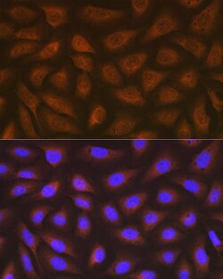 Invitrogen EEF2 Recombinant Rabbit Monoclonal Antibody (4E2Z5) 100 &mu;L;