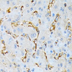 Invitrogen IQGAP1 Recombinant Rabbit Monoclonal Antibody (7I6X1) 100 &mu;L | Buy Online | Invitrogen&trade; | Fisher Scientific