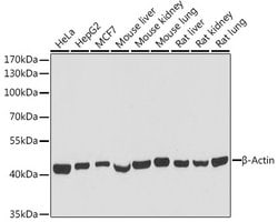 beta Actin Recombinant Rabbit Monoclonal Antibody (0N2H8), HRP, Invitrogen™