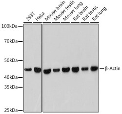 Invitrogen beta Actin Recombinant Rabbit Monoclonal Antibody (4C4) 100