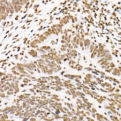 Invitrogen Phospho-STAT3 (Tyr705) Recombinant Rabbit Monoclonal Antibody