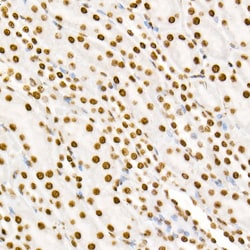 Invitrogen Phospho-STAT3 (Tyr705) Recombinant Rabbit Monoclonal Antibody