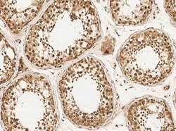 Invitrogen DZIP1 Monoclonal Antibody (05), Invitrogen 100 &mu;L; Unconjugated:Antibodies,