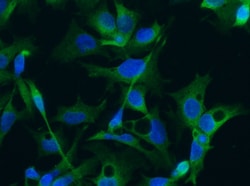 Invitrogen Doublecortin Monoclonal Antibody (01), Invitrogen 50 &mu;L;