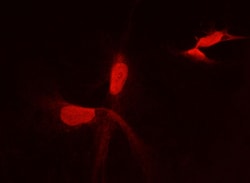 PFDN2 Monoclonal Antibody (04), Invitrogen:Antibodies:Primary Antibodies