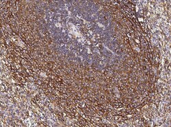 Invitrogen CCR1 Recombinant Rabbit Monoclonal Antibody (003), Invitrogen 100 &mu;L | Buy Online | Invitrogen&trade; | Fisher Scientific