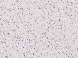 Invitrogen Connexin 43 Recombinant Rabbit Monoclonal Antibody (105), Invitrogen