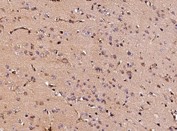 Neuropilin 1 Recombinant Rabbit Monoclonal Antibody (042), Invitrogen:Antibodies:Primary