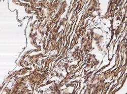 Neuropilin 1 Recombinant Rabbit Monoclonal Antibody (042), Invitrogen:Antibodies:Primary