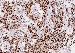 Invitrogen PCNA Recombinant Rabbit Monoclonal Antibody (144), Invitrogen