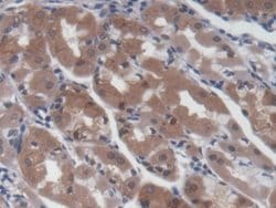 Invitrogen UCP2 Monoclonal Antibody (D7), Invitrogen:Antibodies:Primary